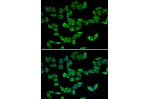 Immunofluorescence analysis of U2OS cells using PRDX5 antibody. (Peroxiredoxin 5 antibody  (AA 53-214))