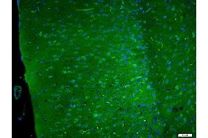 Paraformaldehyde-fixed, paraffin embedded Mouse brain, Antigen retrieval by boiling in sodium citrate buffer (pH6. (DLGAP4 antibody  (AA 261-370))
