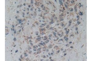 Immunohistochemistry (IHC) image for anti-SMAD, Mothers Against DPP Homolog 5 (SMAD5) (AA 210-464) antibody (ABIN7441760)