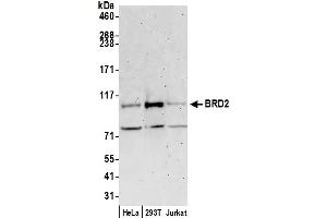 Western Blotting (WB) image for anti-Bromodomain Containing 2 (BRD2) (AA 1-50) antibody (ABIN7453387)