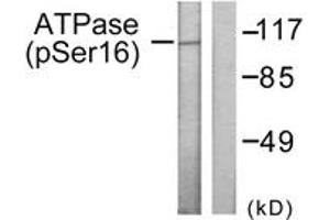 Western blot analysis of extracts from 293 cells treated with PMA 125ng/ml 30', using ATPase (Phospho-Ser16) Antibody. (ATPase antibody  (pSer16))