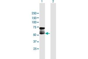 Western Blot analysis of GGT1 expression in transfected 293T cell line by GGT1 MaxPab polyclonal antibody. (GGT1 antibody  (AA 1-569))