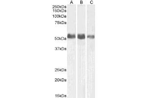 ABIN4902529 (0. (ALPL antibody)