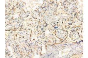 ABIN6261114 and ABIN6266520 at 1/100 staining human normal placenta tissue by IHC-P. (Cullin 1 antibody  (C-Term))