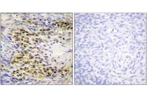 Immunohistochemistry analysis of paraffin-embedded human ovary, using Akt (Phospho-Thr72) Antibody. (AKT1 antibody  (pThr72))