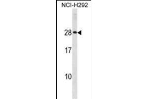 HLA-DQA2 Antibody (Center) (ABIN1881421 and ABIN2839048) western blot analysis in NCI- cell line lysates (35 μg/lane). (HLA-DQA2 antibody  (AA 39-66))