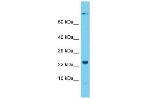 Host: Rabbit  Target Name: Dctn5  Sample Tissue: Rat Stomach lysates  Antibody Dilution: 1. (DCTN5 antibody  (N-Term))