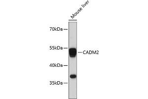 Western blot analysis of extracts of mouse liver, using C antibody (ABIN6129649, ABIN6137839, ABIN6137840 and ABIN6215420) at 1:3000 dilution. (CADM2 antibody  (AA 220-335))