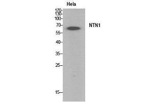 Western Blot (WB) analysis of HeLa cells using Netrin-1 Polyclonal Antibody. (Netrin 1 antibody  (Internal Region))