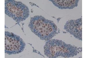 Detection of MUC1 in Rat Testis Tissue using Polyclonal Antibody to Mucin 1 (MUC1) (MUC1 antibody  (AA 404-655))