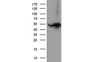 Western Blotting (WB) image for anti-Histidyl-tRNA Synthetase 2, Mitochondrial (Putative) (HARS2) antibody (ABIN1498586)