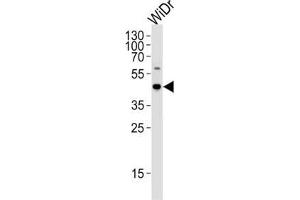 Western Blotting (WB) image for anti-Chromosome 9 Open Reading Frame 72 (C9ORF72) antibody (ABIN2997029) (C9ORF72 antibody)