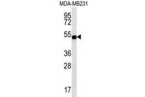 Western Blotting (WB) image for anti-Signal Transducing Adaptor Family Member 2 (STAP2) antibody (ABIN2996919)