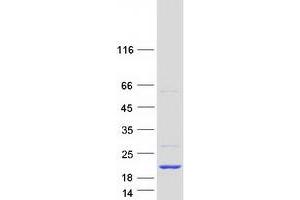 Validation with Western Blot (Ensa Protein (Transcript Variant 8) (Myc-DYKDDDDK Tag))