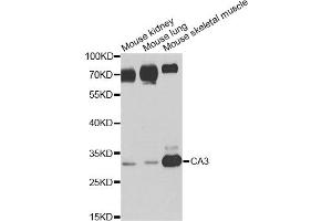 Western blot analysis of extracts of various cell lines, using CA3 antibody. (CA3 antibody)
