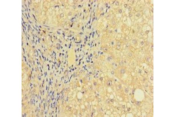 PRICKLE4 antibody  (AA 1-240)