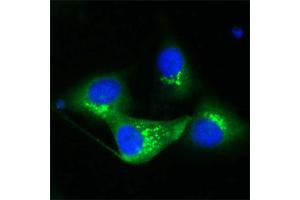 Human Melanoma cell line C 32 was cultured overnight on round cover slides placed in a 24 well tissue culture plate. (TGOLN2 antibody)