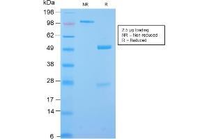 SDS-PAGE (SDS) image for anti-Desmin (DES) antibody (ABIN6939235)