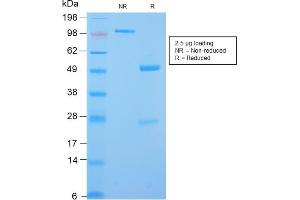 SDS-PAGE Analysis Purified Desmin Rabbit Recombinant Monoclonal Antibody (DES/2960R). (Recombinant Desmin antibody)