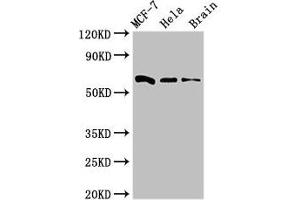 Western Blot Positive WB detected in: MCF-7 whole cell lysate, Hela whole cell lysate, Mouse brain tissue All lanes: SGO1 antibody at 3 μg/mL Secondary Goat polyclonal to rabbit IgG at 1/50000 dilution Predicted band size: 65, 36, 34, 32, 30, 61, 25 kDa Observed band size: 65 kDa (Shugoshin antibody  (AA 260-439))