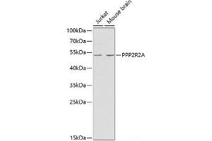 PPP2R2A antibody