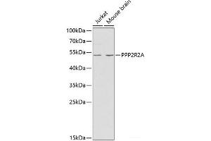 Western blot analysis of extracts of various cell lines using PPP2R2A Polyclonal Antibody at dilution of 1:1000. (PPP2R2A antibody)