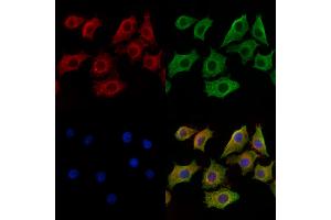 ABIN6259765 and ABIN6269299 staining HepG2 cells by IF/ICC. (ADAM17 antibody  (C-Term))