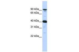 Image no. 1 for anti-Cysteinyl-tRNA Synthetase (CARS) (AA 756-805) antibody (ABIN6740660) (CARS antibody  (AA 756-805))