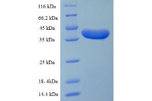 Desmoplakin Protein (DSP) (AA 78-300, partial) (His-SUMO Tag)