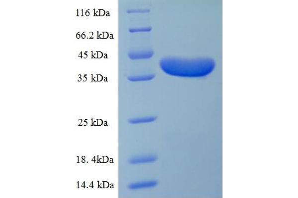 Desmoplakin Protein (DSP) (AA 78-300, partial) (His-SUMO Tag)