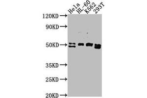Western Blot Positive WB detected in: HeLa whole cell lysate, HL-60 whole cell lysate, K562 whole cell lysate, 293T whole cell lysate All lanes: DDX47 antibody at 1:2000 Secondary Goat polyclonal to rabbit IgG at 1/50000 dilution Predicted band size: 51, 46 kDa Observed band size: 51 kDa (DDX47 antibody  (AA 225-460))