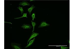Immunofluorescence of monoclonal antibody to DKK1 on HeLa cell.