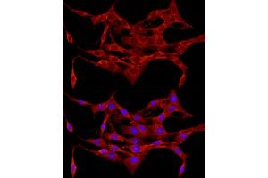 Immunofluorescence (IF) image for anti-Adenomatous Polyposis Coli (APC) (AA 2544-2843) antibody (ABIN1678690)
