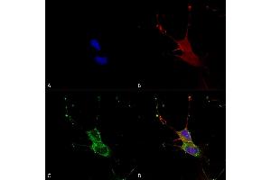 Immunocytochemistry/Immunofluorescence analysis using Mouse Anti-LGI1 Monoclonal Antibody, Clone S283-7 (ABIN1741285). (LGI1 antibody  (AA 37-113) (PE))