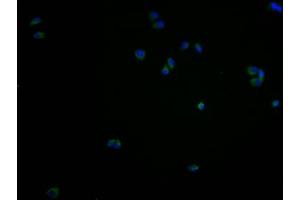 Regulator of G Protein Signaling 9 Binding Protein (RGS9BP) (AA 1-210) antibody
