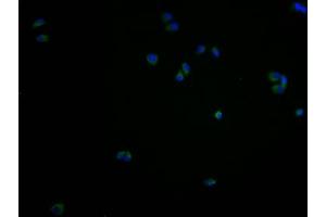 Immunofluorescence staining of PC3 cells with ABIN7167626 at 1:100, counter-stained with DAPI. (Regulator of G Protein Signaling 9 Binding Protein (RGS9BP) (AA 1-210) antibody)
