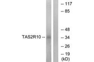 Western blot analysis of extracts from LOVO cells, using TAS2R10 Antibody. (TAS2R10 antibody  (AA 122-171))