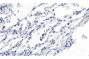 ABIN184738 Negative Control showing staining of paraffin embedded Human Lung, with no primary antibody.