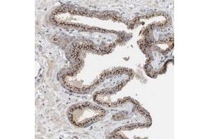 Immunohistochemical staining of human prostate with SLC38A10 polyclonal antibody  shows strong cytoplasmic positivity with a granular pattern in glandular cells at 1:50-1:200 dilution. (SLC38A10 antibody)