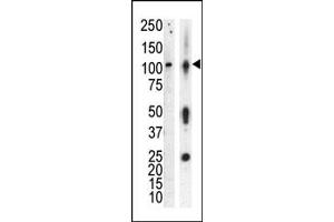 Western blot analysis of anti-PKCnu Pab (ABIN391014 and ABIN2841186) in lysate of HL60 cells stimulated with A (lane A) and mouse brain tissue lysate (lane B).
