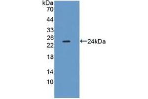Detection of Recombinant XDH, Mouse using Polyclonal Antibody to Xanthine Dehydrogenase (XDH) (XDH antibody  (AA 231-416))