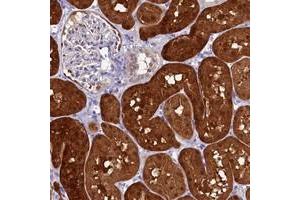 Immunohistochemical staining of human kidney with C11orf54 polyclonal antibody  shows strong cytoplasmic and nuclear positivity in cells in tubules.
