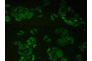 Detection of HIP1R in Human Hela Cells using Polyclonal Antibody to Huntingtin Interacting Protein 1 Related Protein (HIP1R) (HIP1R antibody  (AA 771-1012))