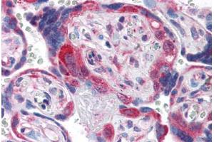 Human Placenta (formalin-fixed, paraffin-embedded) stained with PDGFRA antibody ABIN337400 at 5 ug/ml followed by biotinylated goat anti-rabbit IgG secondary antibody ABIN481713, alkaline phosphatase-streptavidin and chromogen. (PDGFRA antibody  (C-Term))