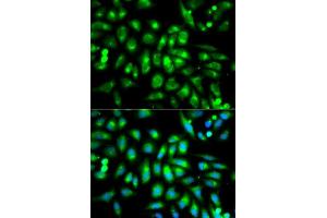 Immunofluorescence analysis of MCF7 cell using CHRM2 antibody. (Muscarinic Acetylcholine Receptor M2 antibody  (AA 208-388))