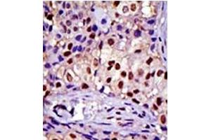 Image no. 1 for anti-RAD23 Homolog A (RAD23A) (C-Term) antibody (ABIN357606) (RAD23A antibody  (C-Term))