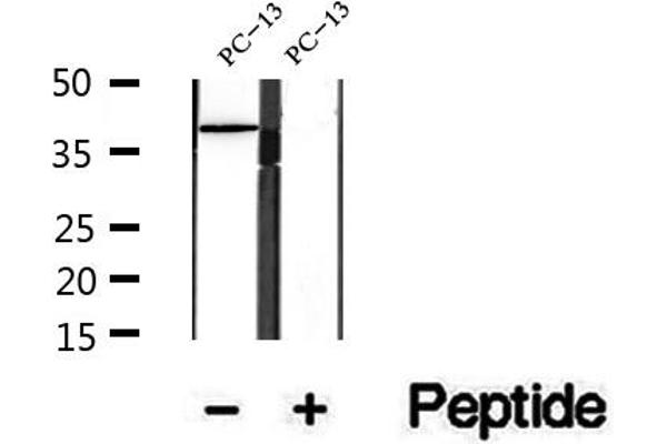 SLC22A12 antibody
