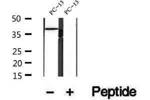 Western blot analysis of extracts of PC-13 cells, using URAT1 antibody. (SLC22A12 antibody)