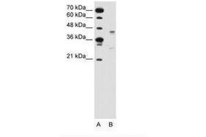 Image no. 2 for anti-G Protein-Coupled Receptor 161 (GPR161) (AA 201-250) antibody (ABIN6736635)
