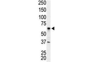 Western blot analysis of IRAK2 antibody and Jurkat cell lysate (IRAK2 antibody  (AA 3-32))